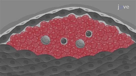 Sudan IV Staining: A Procedure for Staining Lipid .